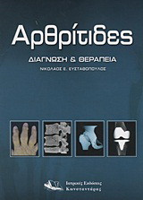 Αρθρίτιδες