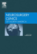 Neuroendovascular Surgery
