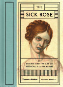 The Sick Rose