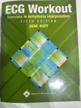Ecg workout exercises in arrhythmia interpretation