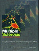 Multiple Sclerosis