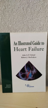 An Illustrated guide to heart failure