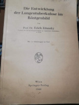 Die Entwicklung der Lungentuberkulose I'm Rontgenbild