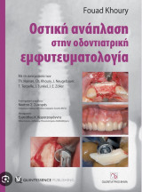 Οστική ανάπλαση στην οδοντιατρική εμφυτευματολογία