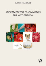 Αποκαταστάσεις ελλειμμάτων της κάτω γνάθου