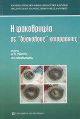 Η φακοθρυψία σε δύσκολους καταρράκτες